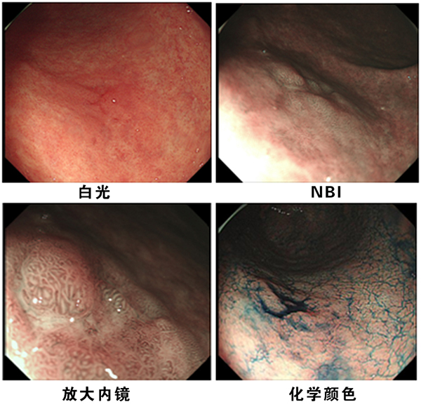 δ(bio)}-1.jpg